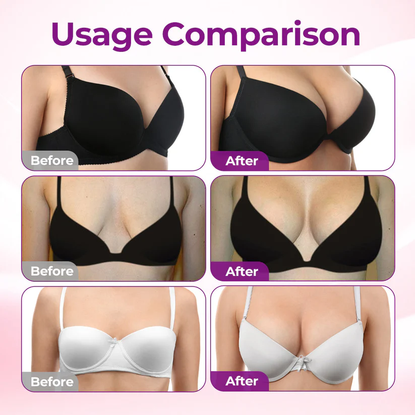 💥Jorvian® 👩‍⚕️ Targeted Breast Enhancement Advanced Nano Microneedle Patch💃