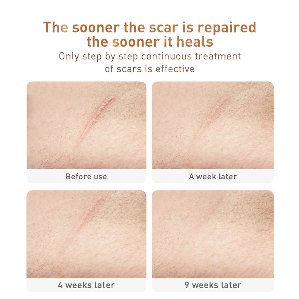 Herbal Repair Gel for Scar Removal-1